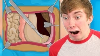 STOMACH SURGERY (iPhone Gameplay Video)