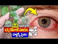 ఎలాంటి కంటి సమస్యలైనా ఒక్కరోజులో మాయం || eyesight increase remedy #kskhome