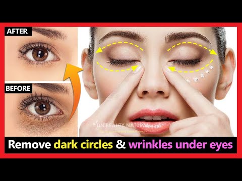 9 Causes of Dark Eye Circles - Take action to reduce dark circles under eyes  with natural, noninvasive methods - Blissoma Botanical Beauty