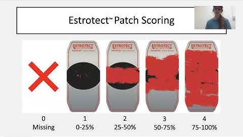7 & 7 Synch -- Carson Andersen
