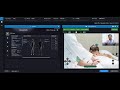 Teleicu solution for critical care