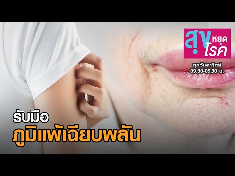 วีดีโอ: 3 วิธีในการลดอาการปากบวม