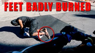 Biker Sees Burned Man Crawling in the Middle of The Road | Bikers Helping People