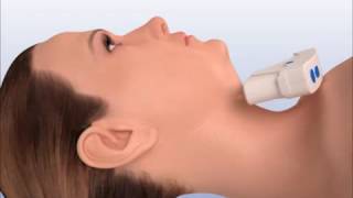 Ultherapy Uygulaması Ankara