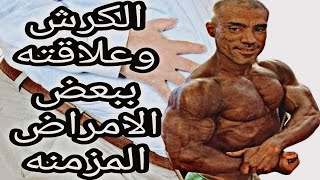 الكرش وعلاقته ببعض الامراض المزمنه _أسباب ظهور الكرش (كيفية التخلص من الكرش بسرعة)