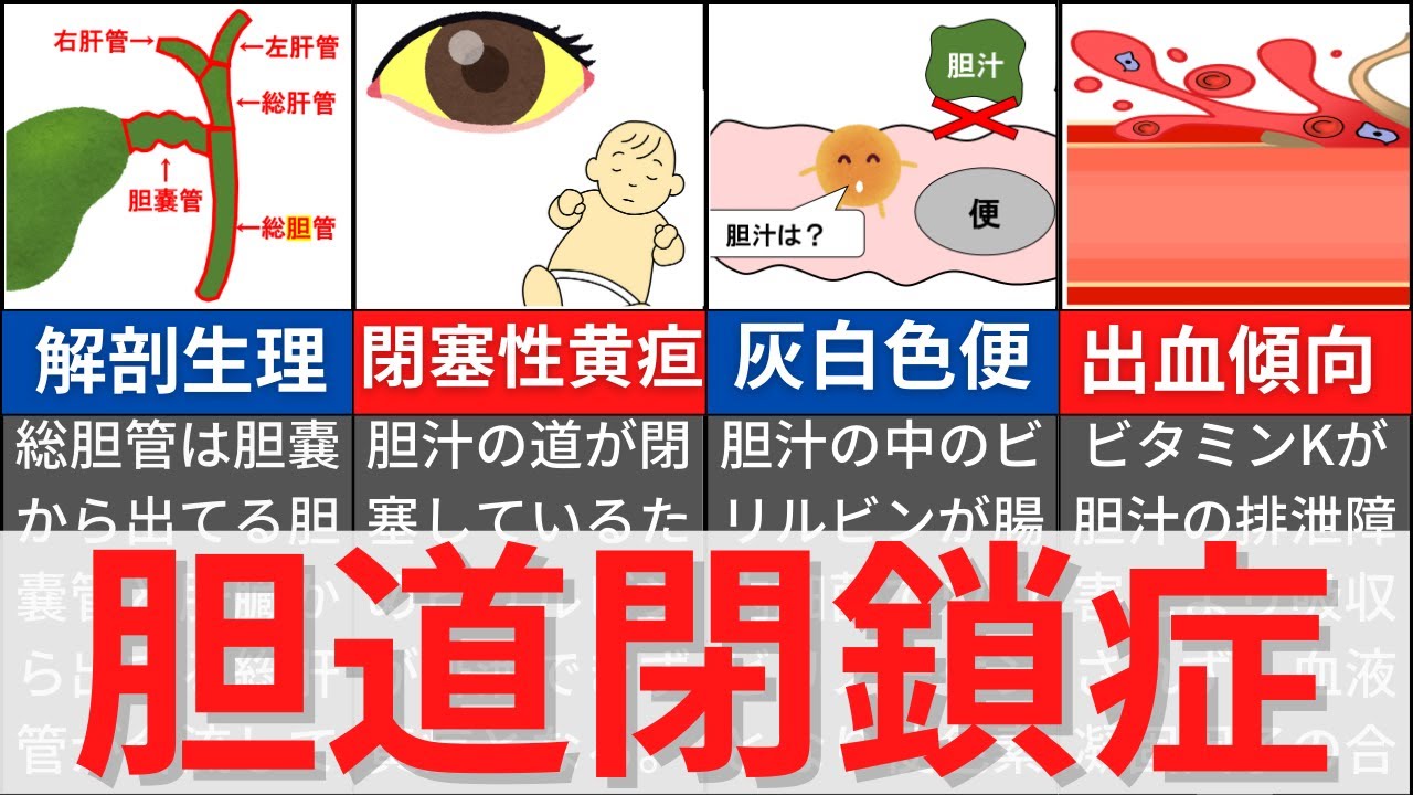 【18分で解説、30分で国試問題】胆道閉鎖症について解説