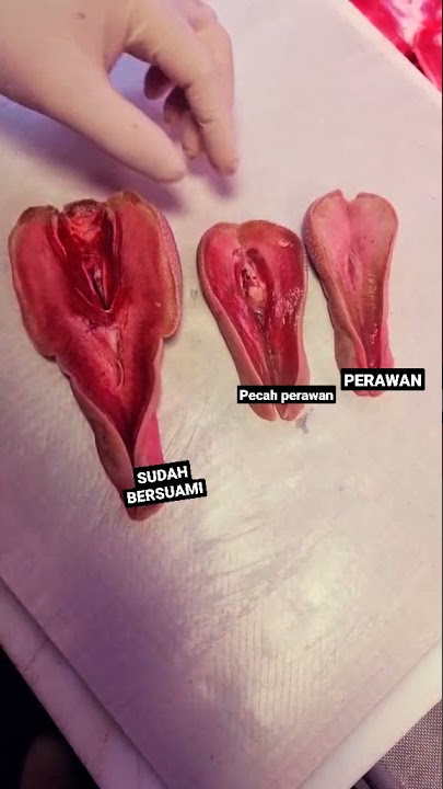 PERBEDAAN PECAHNYA PERAWAN PADA PEREMPUAN#shorts ,#trending DI SUBSCRIBE 👇