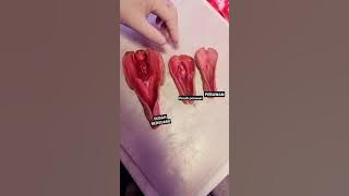 PERBEDAAN PECAHNYA PERAWAN PADA PEREMPUAN#shorts ,#trending DI SUBSCRIBE 👇