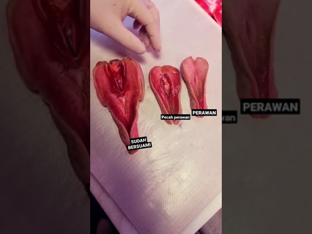 PERBEDAAN PECAHNYA PERAWAN PADA PEREMPUAN#shorts ,#trending DI SUBSCRIBE 👇 class=