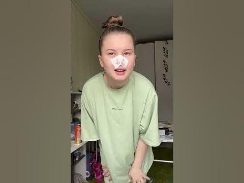 Убираю черные точки 🌑 - YouTube