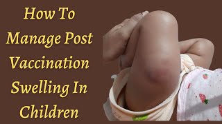 How To Manage Post Vaccination Swelling In Children - Dr Pasunuti Sumanth screenshot 3