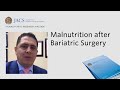 Malnutrition after Bariatric Surgery | JACS Talking Points | ACS