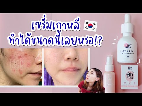 สิวหายภายใน 10 วัน! เซรั่มโอมีจาร์ จากเกาหลี Omijar Serum ขาวใสฉ่ำวาว ทำไมเราเพิ่งเจอกันน | Cozy T