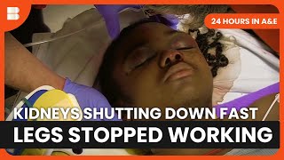 Muscle Breakdown Emergency at Kings College A&E | 24 Hours in A&E