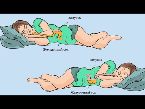 Вот почему вам следует спать на левом боку