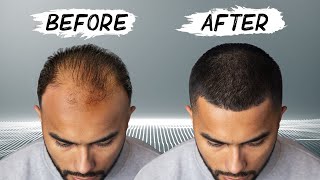 6 Hairstyle Mistakes Men Make