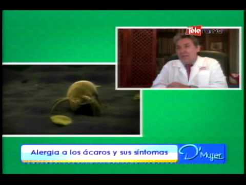 ALERGIA A LOS ACAROS 