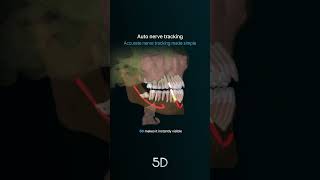 Auto Nerve Tracking