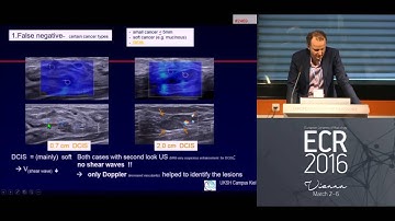 ECR 2016 Symposium - Clinical Innovations Improving Breast Cancer Diagnosis - Prof. Schäfer