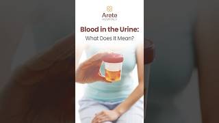 Blood in Urine – What Does It Mean | Dr Khizar Raoof Explains