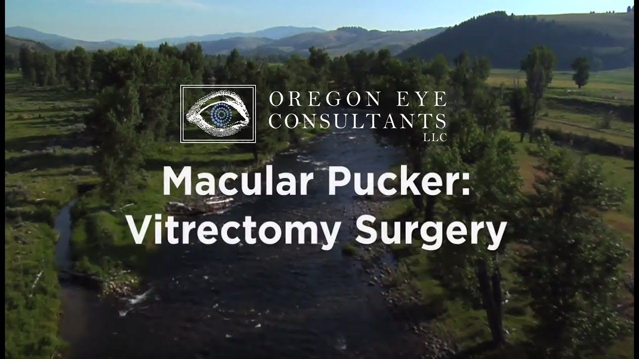 Retina Macular Pucker Vitrectomy