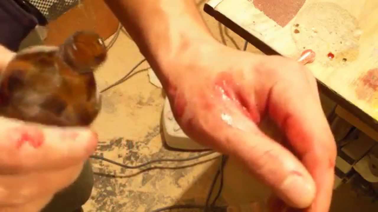 Как себе помочь при порезе