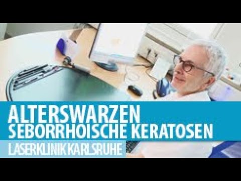 Seborrhoische Keratosen (Alterswarzen)