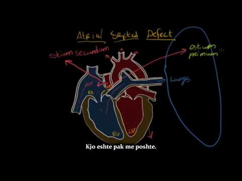 Video: Defekti Kongjenital I Zemrës (defekti Septal Atrial) Te Macet