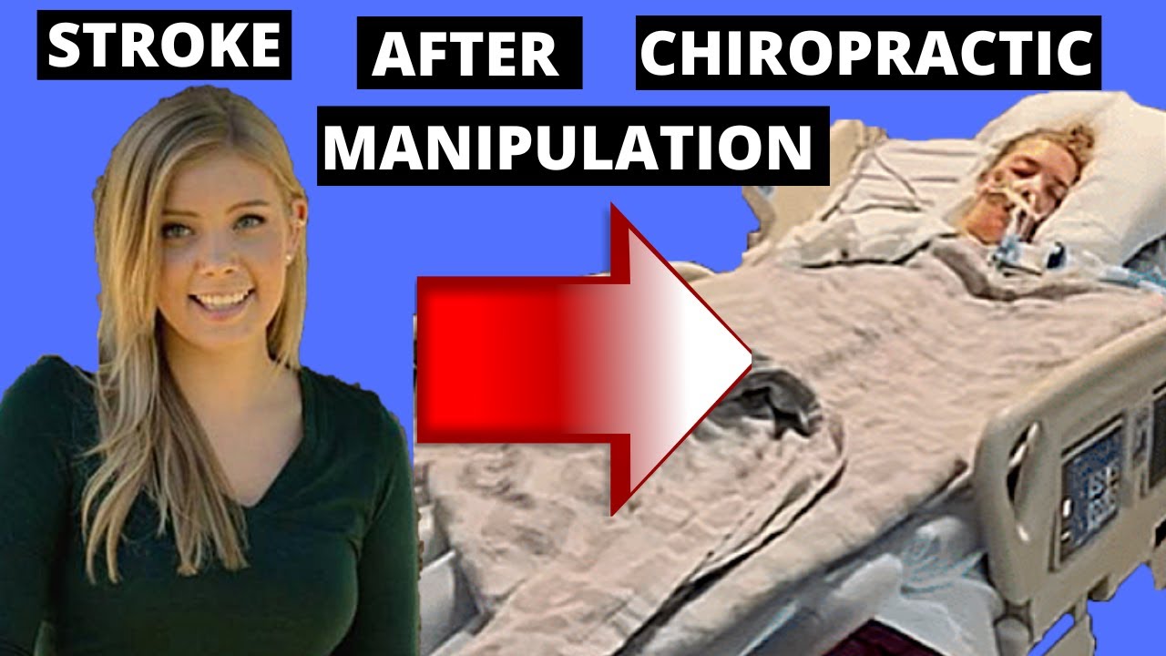 Neurologist Explains Stroke After Chiropractic Manipulation [Caitlin