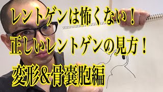 第33回【股関節痛】実は、そんなにレントゲン写真の形って大事じゃないんです！