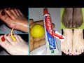 Foot Whitening Colgate Toothpaste At Home Remedies | Feet Whitening Pedicure At Home