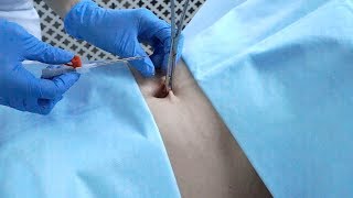 Пирсинг или  прокол пупка | косметология Самара  влог |  body piercing