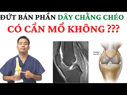 Video: Làm thế nào để bổ sung thêm vitamin A: 13 bước