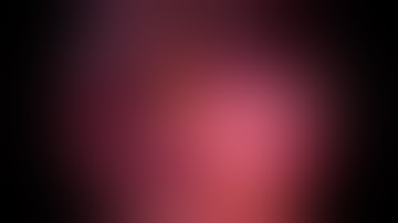 Laparoscopic Choledochal cyst excision by Dr M N Saravanan