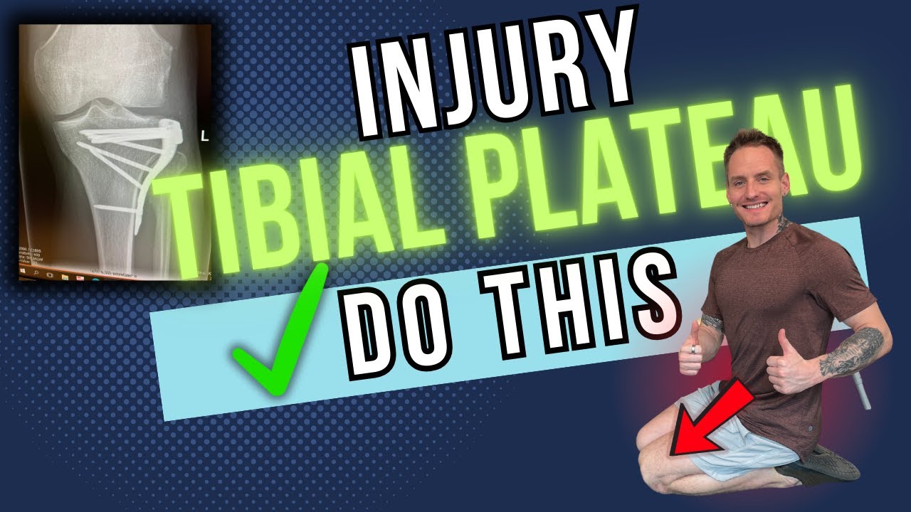 Перелом плато большеберцовой кости — ключевые советы для более быстрого выздоровления и распростр...