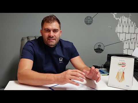 Što je paradontoza - Ivan Antolković, DMD - Dental Centar 4Smile