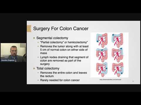 Overview of Colon and Rectum Surgical Options