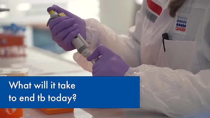 World TB Day: United, we can save lives