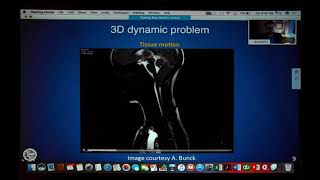Quantitative MRI-based Diagnostics for Chiari Malformation - Bryn A. Martin, PhD
