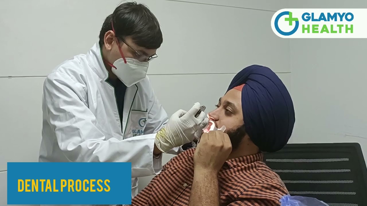 Glamyo Dental Treatment in India | Invisible Braces-Process & Cost | How Teeth Scanning Done