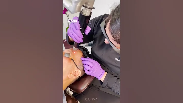 Managing Melasma with PicoSure Laser