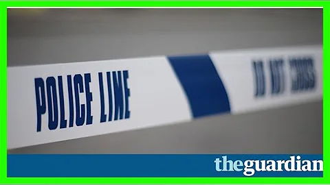 London woman appeals for return of prosthetic limbs stolen from car