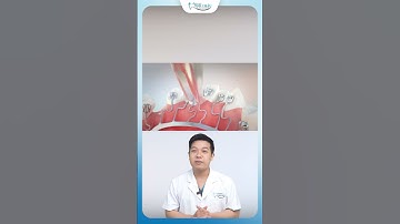 Niềng Răng Mặt Trong | Nha Khoa Minh Châu