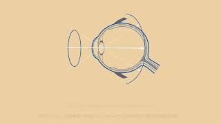 Miyosmart -Technical Hoya