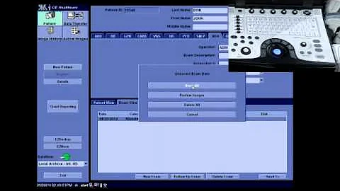 NextGen LOGIQ e: End Exam