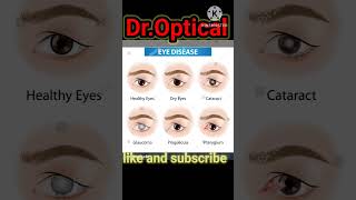 eye disease optometrist love#optometrists #optical #eyes eye disease optometrist love#optometrists #optical #eyes