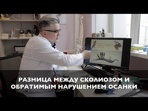 Нарушение осанки или сколиоз? | Когда нужна операция при сколиотической болезни?