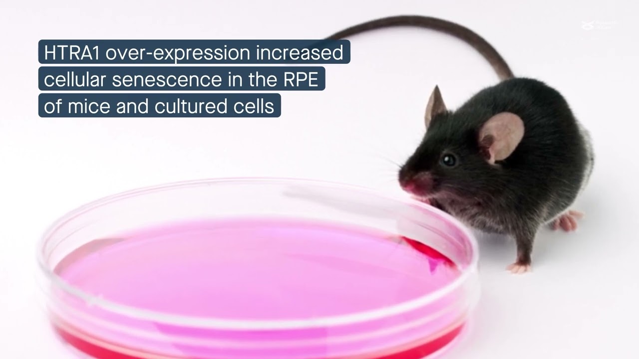 Inhibiting HIF-1 signaling reduces HTRA1-induced retinal degeneration