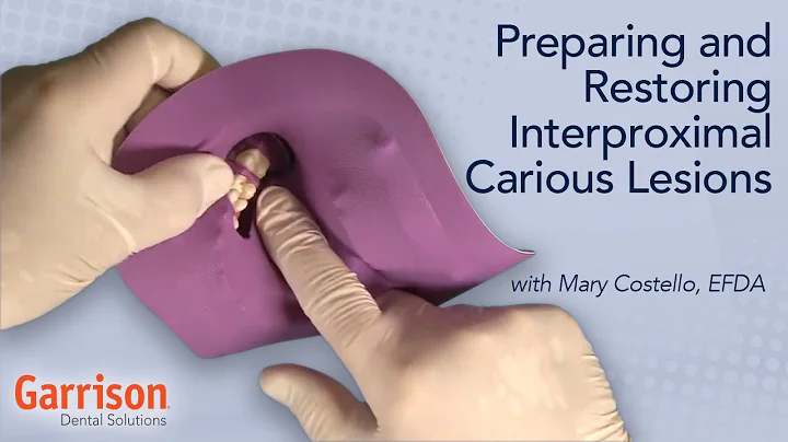 Preparing and Restoring Interproximal Carious Lesi...