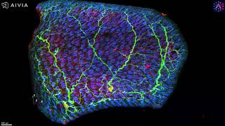 3D imaging of nerve branching in mouse skin biopsy using light sheet microscopy